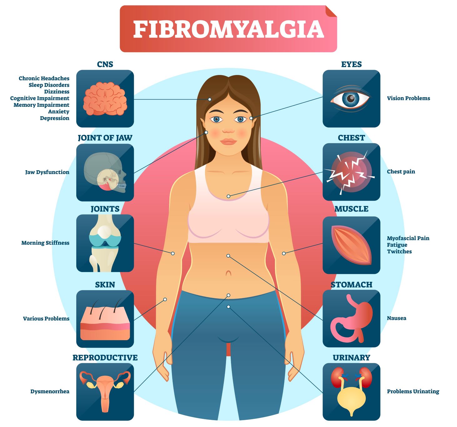 Fibromialgija simptomi